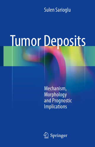 Tumor Deposits: Mechanism, Morphology and Prognostic Implications