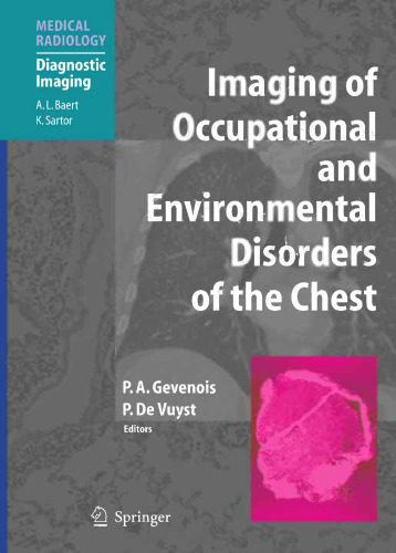 Imaging of Occupational and Environmental Disorders of the Chest