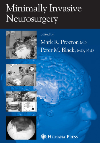 Minimally Invasive Neurosurgery