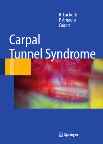 Carpal Tunnel Syndrome