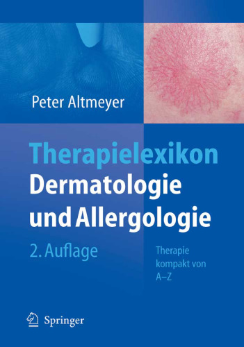 Therapielexikon Dermatologie und Allergologie 2. Auflage