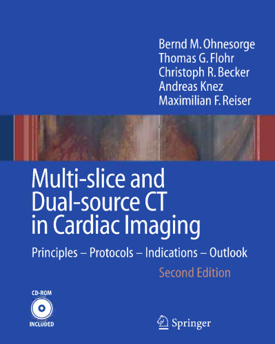 Multi-slice and Dual-source CT in Cardiac Imaging: Principles — Protocols — Indications — Outlook