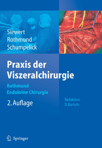 Praxis der Viszeralchirurgie: Gastroenterologische Chirurgie 2. Auflage