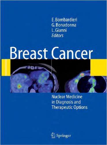 Breast Cancer: Nuclear Medicine in Diagnosis and Therapeutic Options