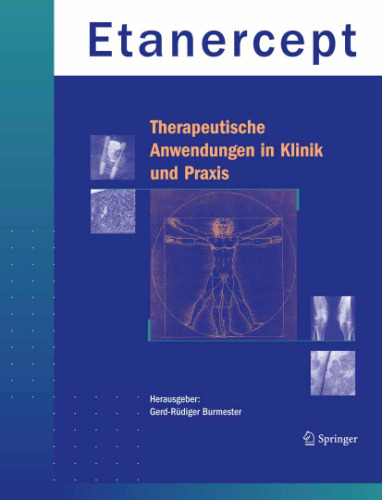 Etanercept - Therapeutische Anwendung in Klinik und Praxis