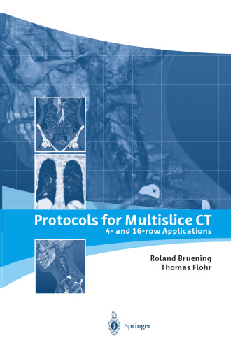 Protocols for Multislice CT: 4- and 16-row Applications