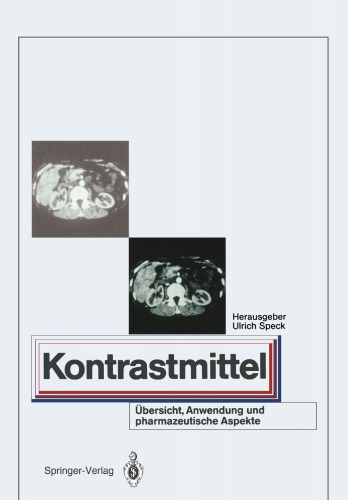 Kontrastmittel: Ubersicht, Anwendung und pharmazeutische Aspekte