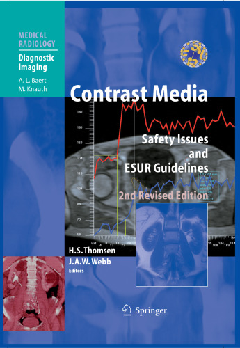 Contrast Media: Safety Issues and ESUR Guidelines