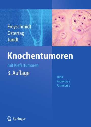 Knochentumoren mit Kiefertumoren: Klinik - Radiologie - Pathologie (German Edition)