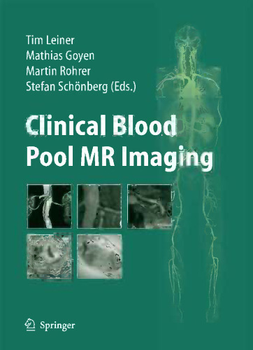 Clinical Blood Pool MR Imaging