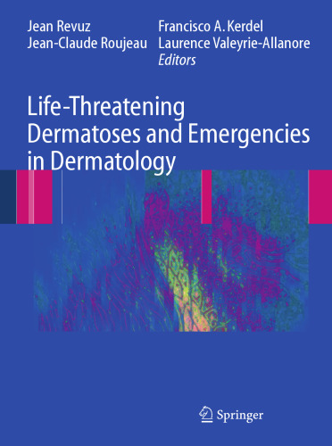 Life-Threatening Dermatoses and Emergencies in Dermatology