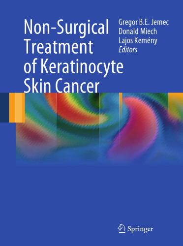 Non-Surgical Treatment of Keratinocyte Skin Cancer