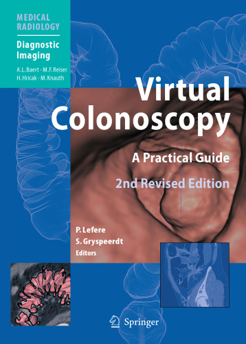 Virtual Colonoscopy: A Practical Guide