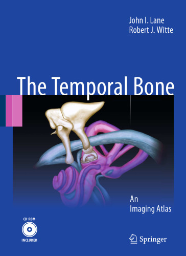 The Temporal Bone: An Imaging Atlas