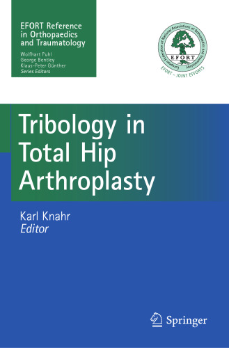 Tribology in Total Hip Arthroplasty