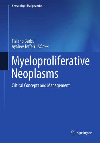 Myeloproliferative Neoplasms: Critical Concepts and Management