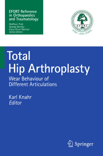 Total Hip Arthroplasty: Wear Behaviour of Different Articulations