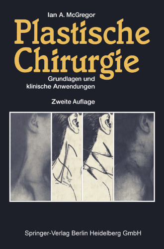 Plastische Chirurgie: Grundlagen und klinische Anwendungen