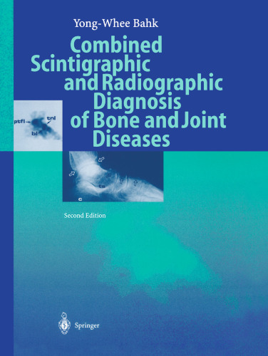 Combined Scintigraphic and Radiographic Diagnosis of Bone and Joint Diseases