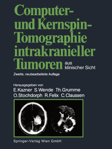 Computer- und Kernspin-Tomographie intrakranieller Tumoren aus klinischer Sicht