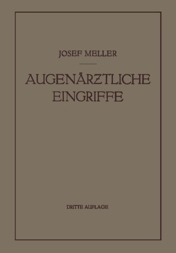 Augenärztliche Eingriffe: Ein Kurzes Handbuch für Angehende Augenärzte