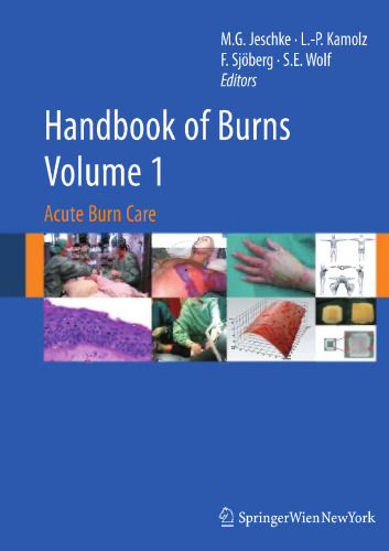 Handbook of Burns: Acute Burn Care Volume 1