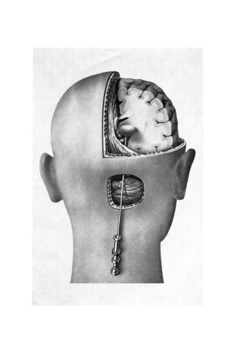 Open Mesencephalotomy and Thalamotomy for Intractable Pain