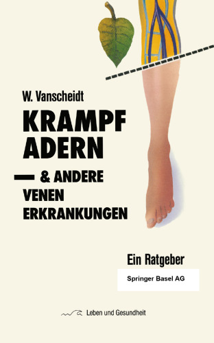Krampfadern und andere Venenerkrankungen: Ein Ratgeber