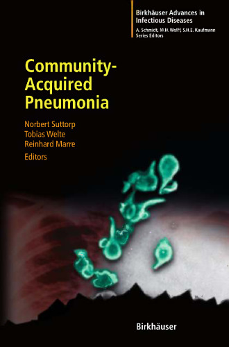 Community-Acquired Pneumonia