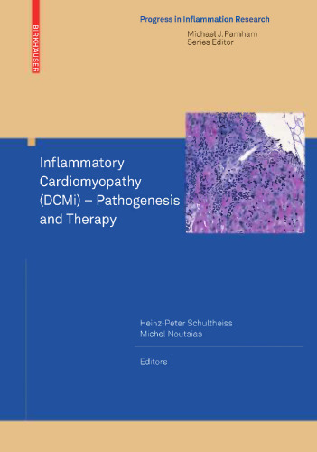 Inflammatory Cardiomyopathy (DCMi): Pathogenesis and Therapy