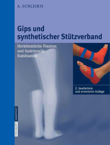 Gips und synthetischer Stützverband : herkömmliche Fixation und funktionelle Stabilisation