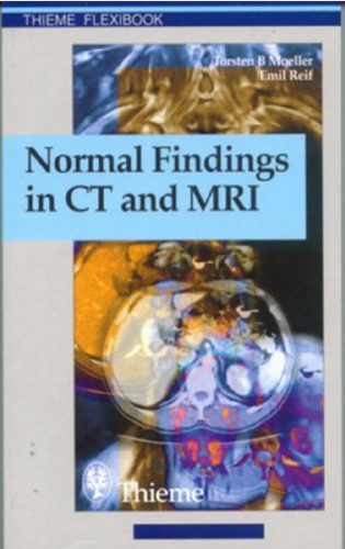 Normal Findings in Ct and Mri