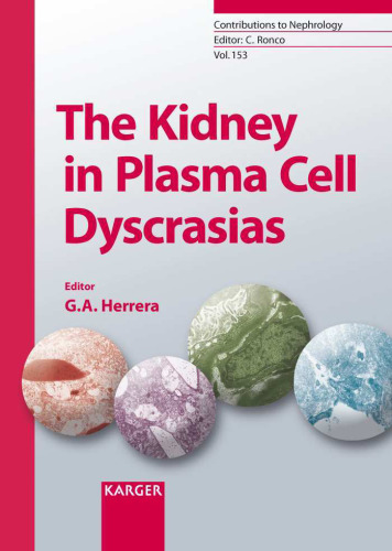 The kidney in plasma cell dyscrasias