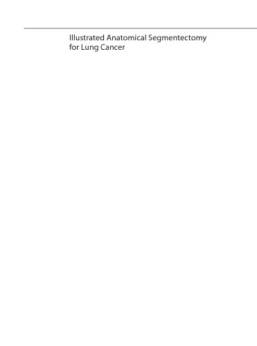 Illustrated Anatomical Segmentectomy for Lung Cancer