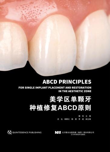 美学区单颗牙种植修复ABCD原则