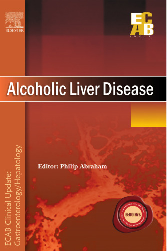 Alcoholic Liver Disease - ECAB