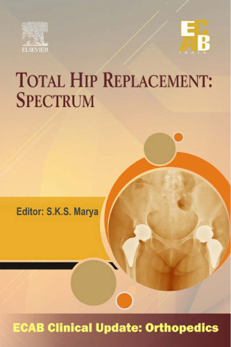 Total Hip Replacement Spectrum - ECAB