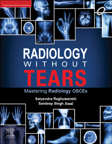 Radiology Without Tears - Mastering Radiology OSCEs (Aug 7, 2024)_(9788131269404)_(Elsevier India).pdf
