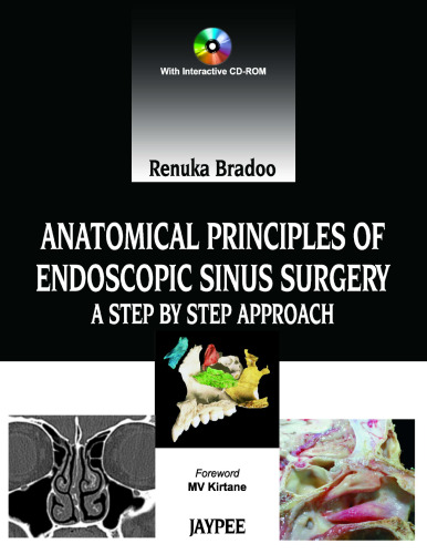 Anatomical principles of endoscopic sinus surgery : a step by step approach.