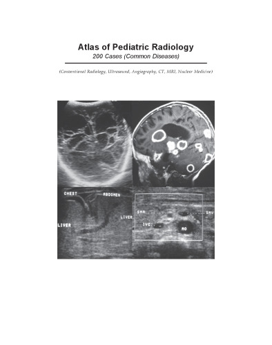 Atlas of Pediatric Radiology