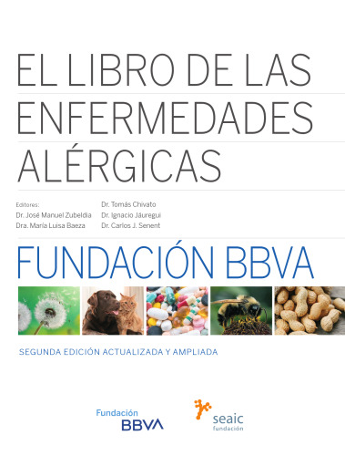El Libro de las Enfermedades Alérgicas
