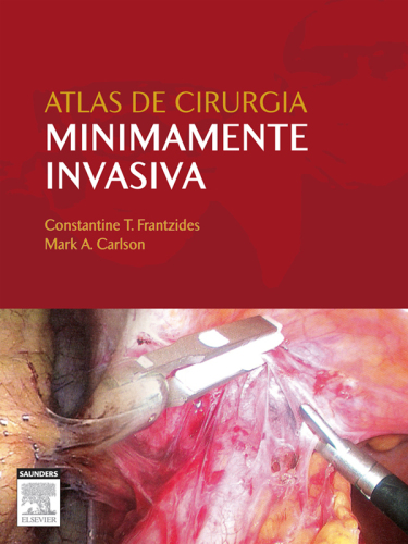 Atlas De Cirurgia Minimamente Invasiva 1ED