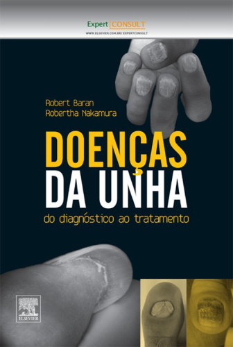 Doenças Da Unha 1ED: Do Diagnóstico ao Tratamento