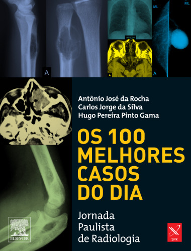 Os 100 Melhores Casos Do Dia 1ED
