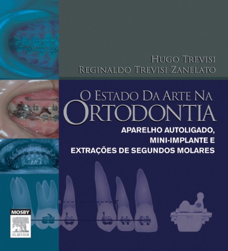 O Estado Da Arte Na Ortodontia 1ED