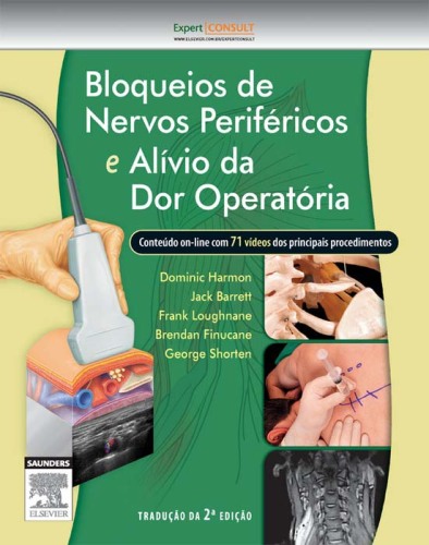 Bloqueios De Nervos Periféricos E Alívio Da Dor Operatória 2ED