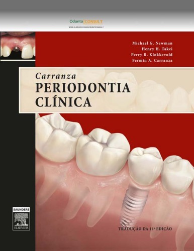 Carranza Periodontia Clínica 11ED