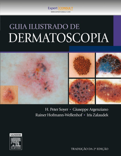 Guia Ilustrado De Dermatoscopia 2ED