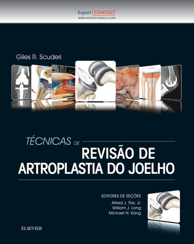 Técnicas de Revisão de Artroplastia do Joelho 1ED