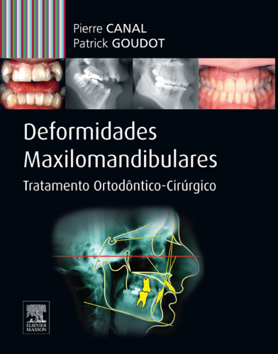 Deformidades Maxilo-mandibulares 1ED